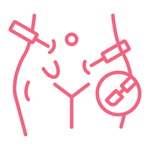 Cirurgia Laparoscópica