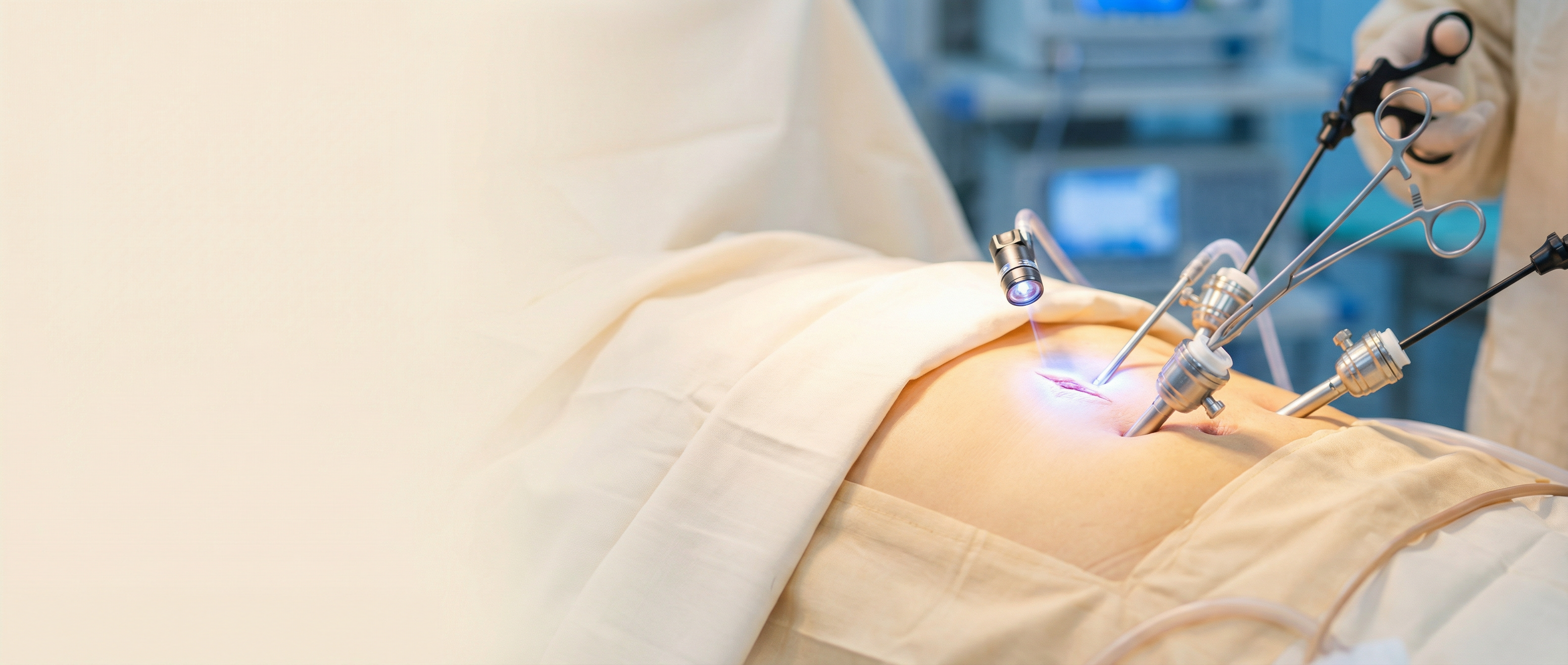 Cirurgia Laparoscópica